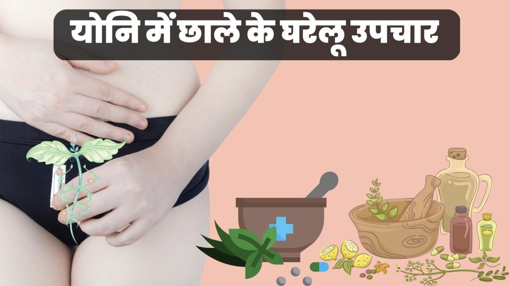 योनि में छाले के घरेलू उपचार
