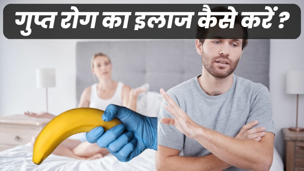 गुप्त रोग का इलाज
