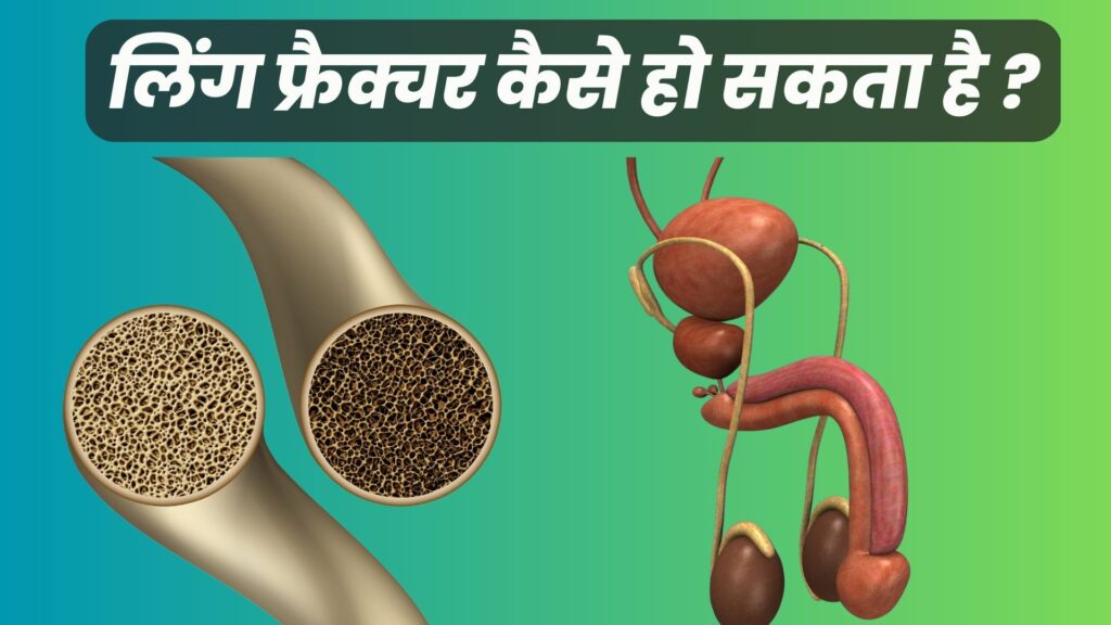 लिंग फ्रैक्चर कैसे हो सकता है