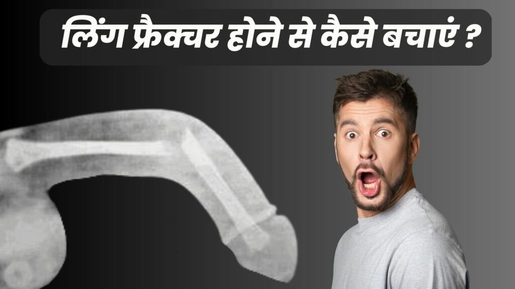 लिंग फ्रैक्चर होने से कैसे बचाएं