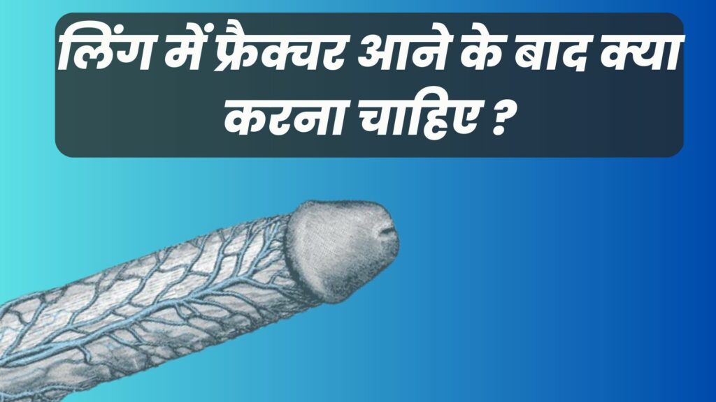 लिंग में फ्रैक्चर आने के बाद