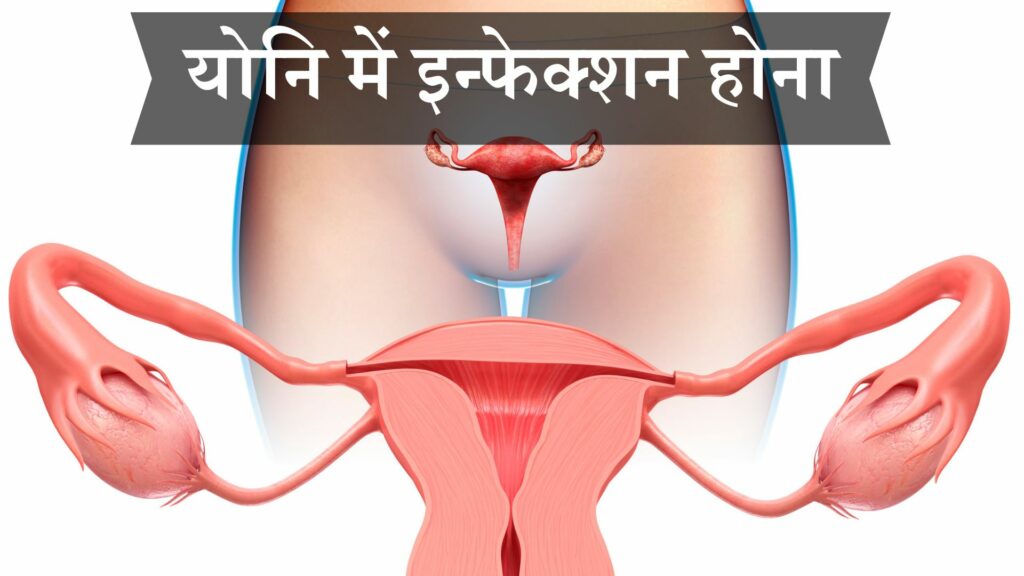 योनि में इन्फेक्शन होना