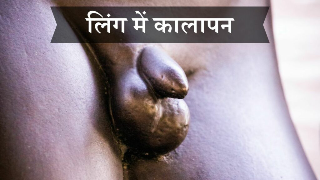 लिंग में कालापन क्यों