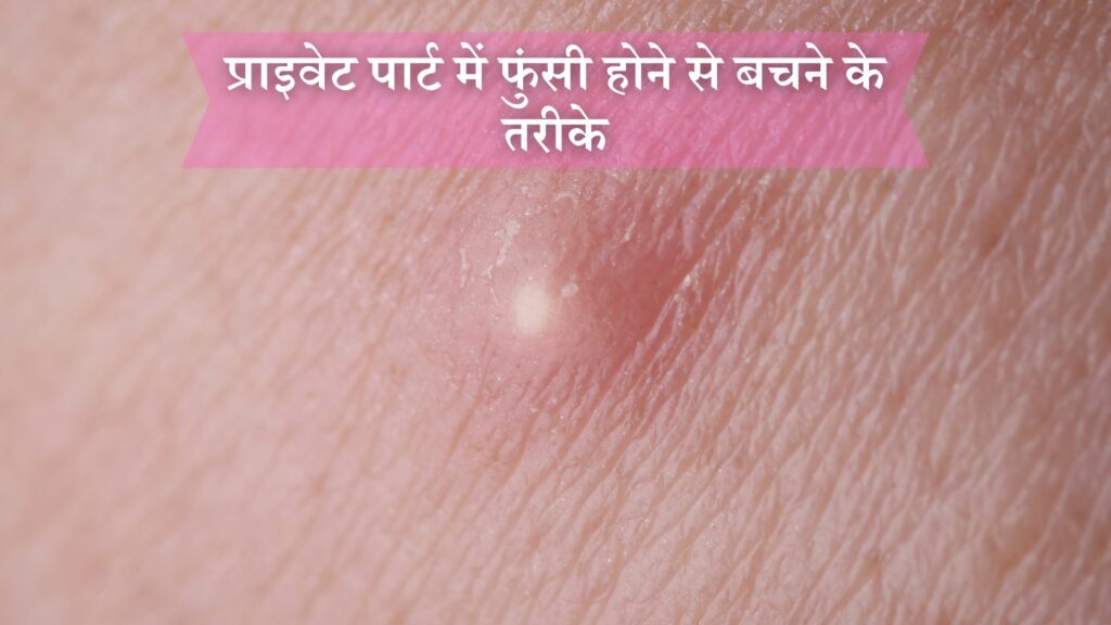 प्राइवेट पार्ट में फुंसी होने से बचने के तरीके