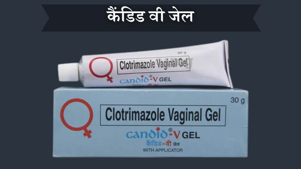 कैंडिड वी जेल