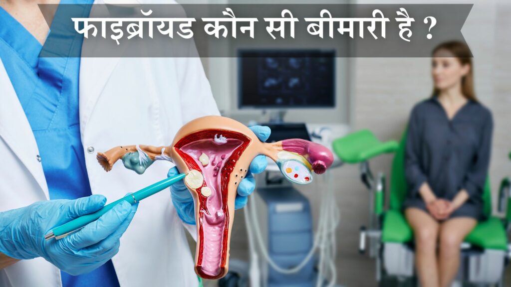 फाइब्रॉयड कौन सी बीमारी है