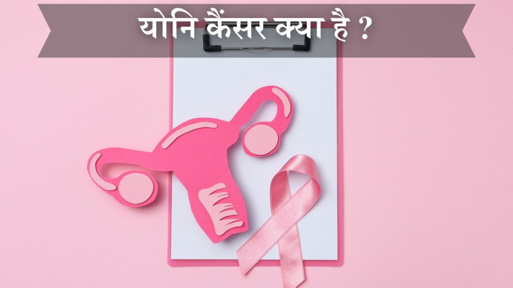 योनि कैंसर क्या है