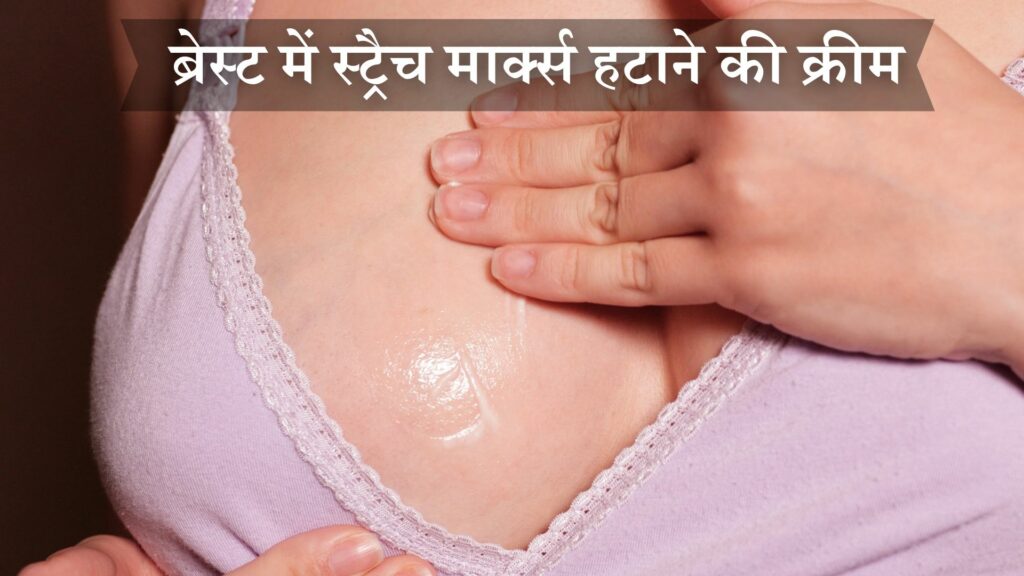 ब्रेस्ट में स्ट्रैच मार्क्स हटाने की क्रीम